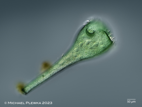 Stentor coeruleus