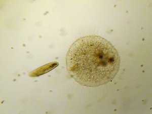 Sonnentierchen mit Pantoffeltierchen
